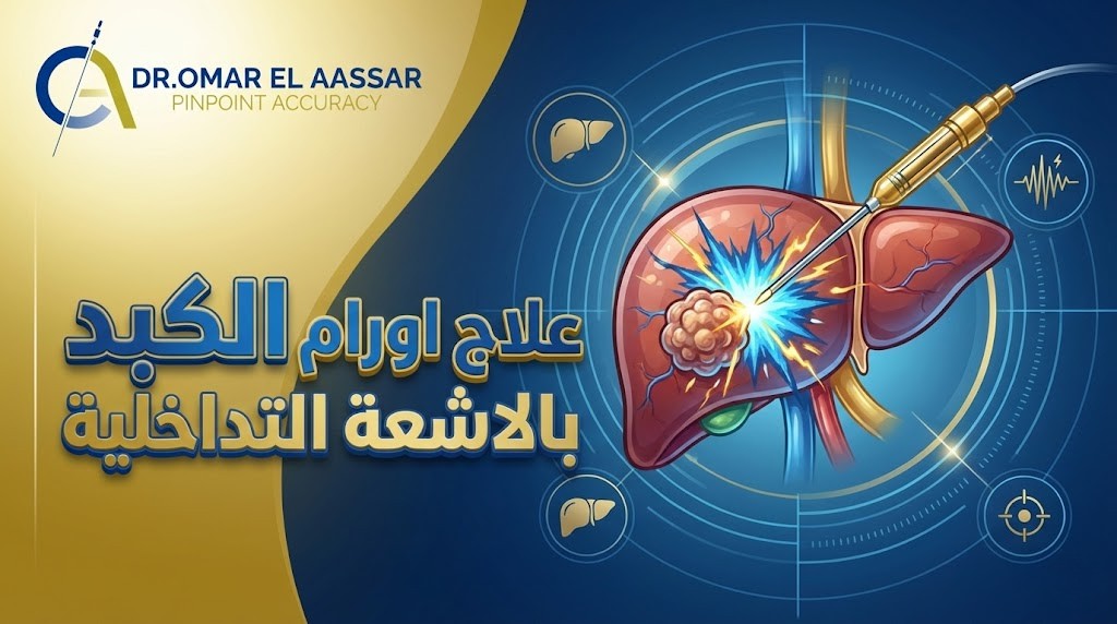 علاج اورام الكبد بالاشعة التداخلية