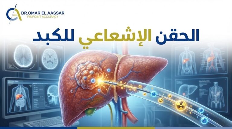 الحقن الإشعاعي للكبد
