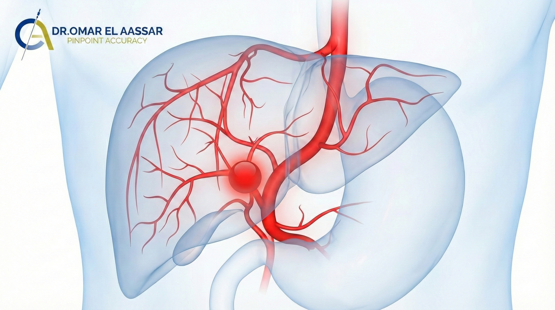 معنى بؤرة في الكبد