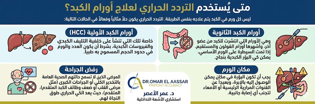 متى يُستخدم التردد الحراري لعلاج أورام الكبد؟