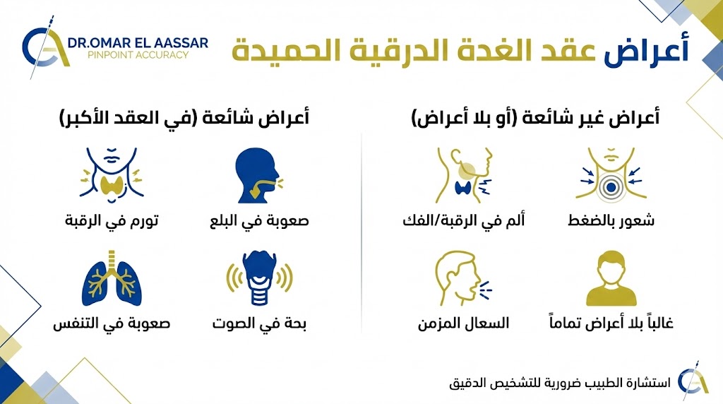 أعراض عقد الغدة الدرقية الحميدة